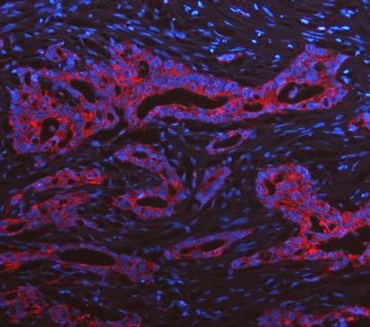 pb9715 krt19 primary antibodies if testing 20_1