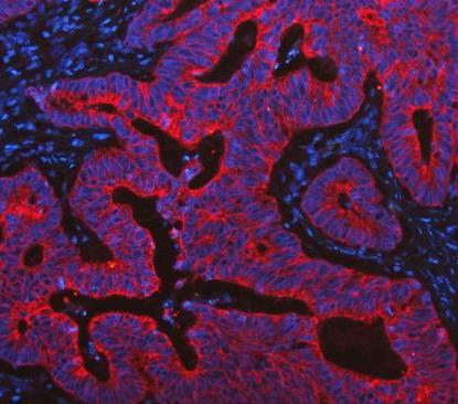 pb9715 krt19 primary antibodies if testing 21_1