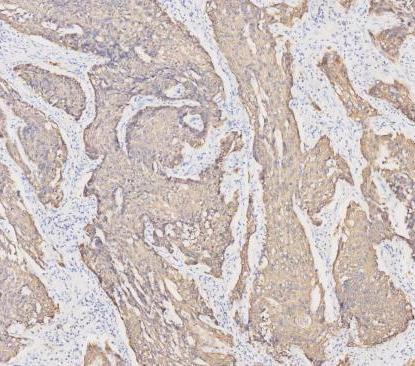 pb9715 krt19 primary antibodies ihc testing 10_1