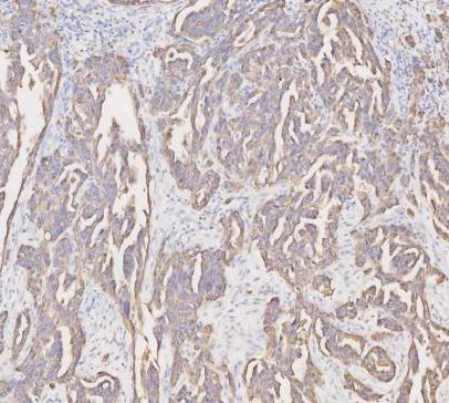 pb9715 krt19 primary antibodies ihc testing 11_1