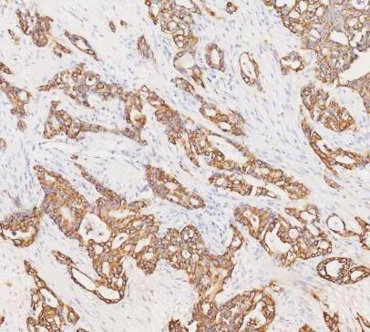 pb9715 krt19 primary antibodies ihc testing 12_2