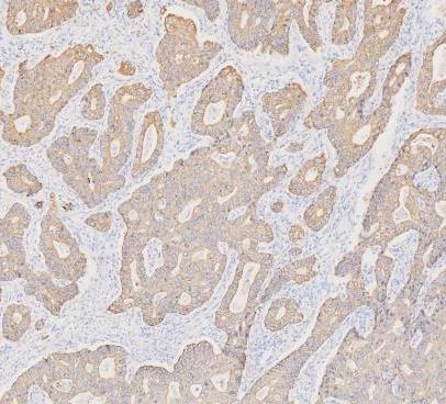 pb9715 krt19 primary antibodies ihc testing 13_2