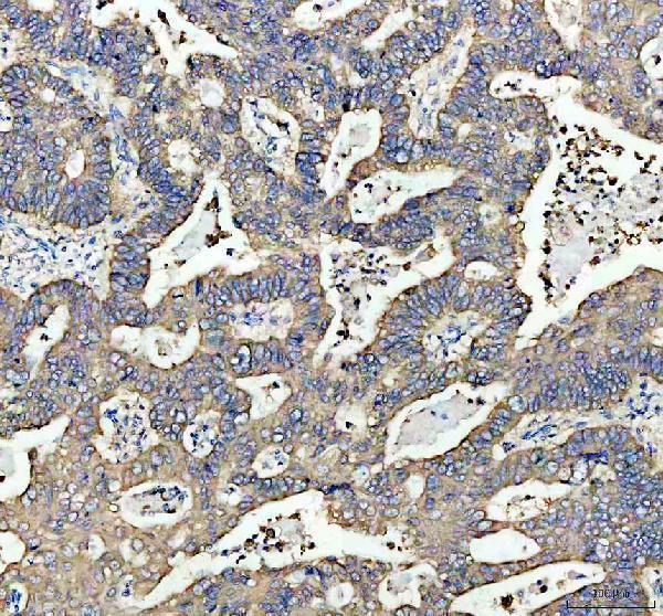 pb9723 mgst1 primary antibodies ihc testing 3