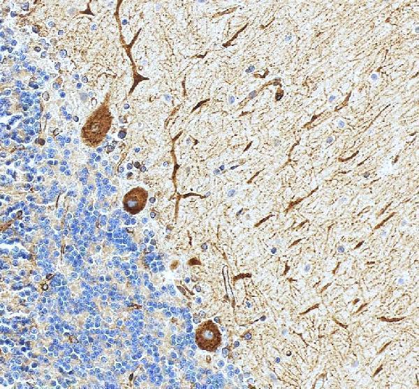IHC analysis of PAK5/PAK7 using anti-PAK5/PAK7 antibody (PB9733)