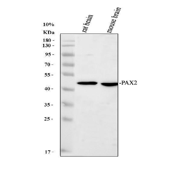 Western blot analysis of Pax2 using anti-Pax2 antibody (PB9734)