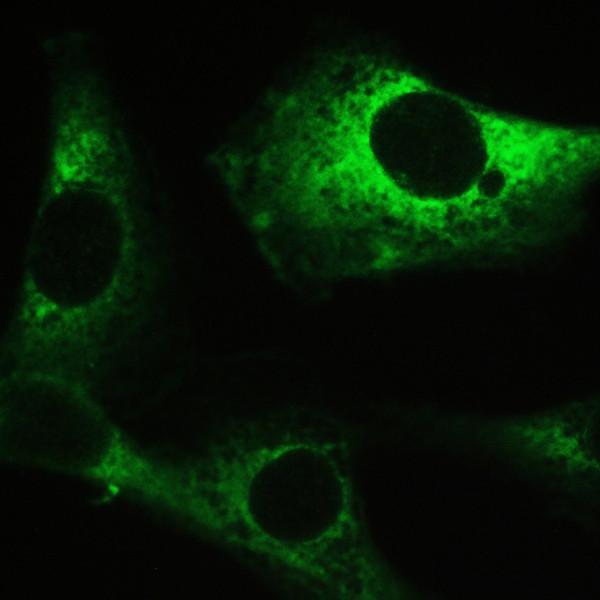  IHC analysis of PPP1R12A using anti-PPP1R12A antibody (PB9737)