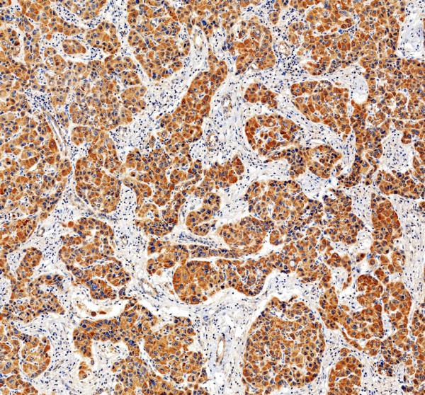 pb9738 prkab1 primary antibodies ihc testing 1