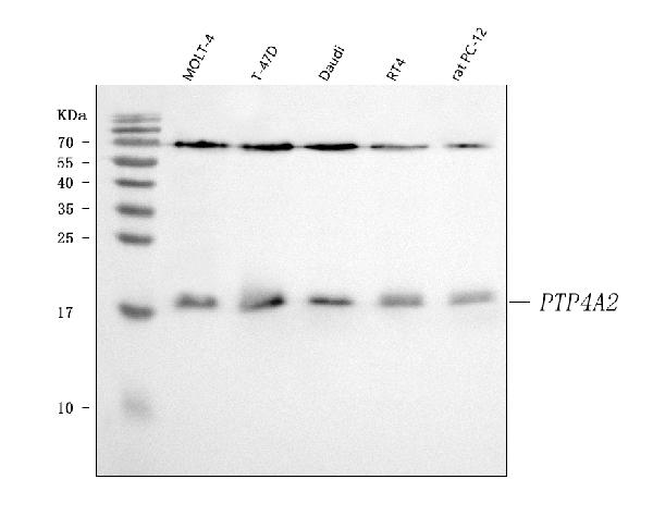 Figure 1. Western blot analysis of PTP4A2 using anti-PTP4A2 antibody (PB9740). Electrophoresis was performed on a 5-20% SDS-PAGE gel at 70V (Stacking gel) / 90V (Resolving gel) for 2-3 hours. The sample well of each lane was loaded with 30 ug of sample under reducing conditions. Lane 1: human MOLT-4 whole cell lysates, Lane 2: human T-47D whole cell lysates, Lane 3: human Daudi whole cell lysates, Lane 4: human RT4 whole cell lysates, Lane 5: rat PC-12 whole cell lysates. After electrophoresis, proteins were transferred to a nitrocellulose membrane at 150 mA for 50-90 minutes. Blocked the membrane with 5% non-fat milk/TBS for 1.5 hour at RT. The membrane was incubated with rabbit anti-PTP4A2 antigen affinity purified polyclonal antibody (Catalog # PB9740) at 0.5 microg/mL overnight at 4°C, then washed with TBS-0.1%Tween 3 times with 5 minutes each and probed with a goat anti-rabbit IgG-HRP secondary antibody at a dilution of 1:5000 for 1.5 hour at RT. The signal is developed using an Enhanced Chemiluminescent detection (ECL) kit (Catalog # EK1002) with Tanon 5200 system. A specific band was detected for PTP4A2 at approximately 19 kDa. The expected band size for PTP4A2 is at 19 kDa.