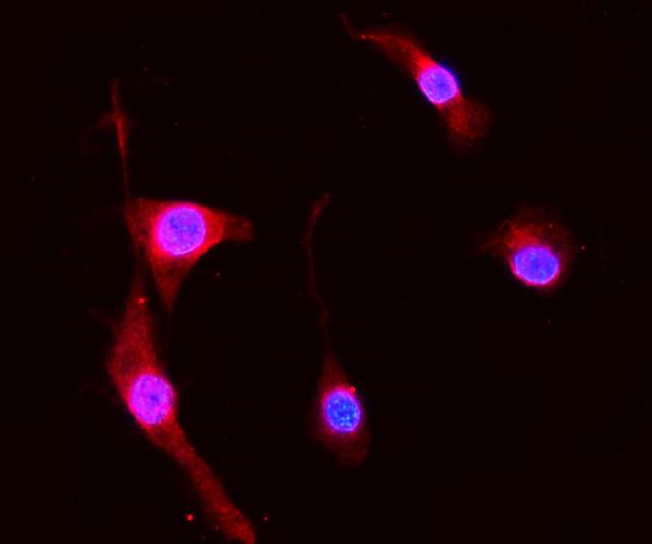 Figure 4. IF analysis of S100A8 using anti-S100A8 antibody (PB9742). S100A8 was detected in immunocytochemical section of NIH3T3 cells. Enzyme antigen retrieval was performed using IHC enzyme antigen retrieval reagent (AR0022) for 15 mins. The cells were blocked with 10% goat serum. And then incubated with 2microg/mL rabbit anti-S100A8 Antibody (PB9742) overnight at 4°C. Cy3 Conjugated Goat Anti-Rabbit IgG (BA1032) was used as secondary antibody at 1:100 dilution and incubated for 30 minutes at 37°C. The section was counterstained with DAPI. Visualize using a fluorescence microscope and filter sets appropriate for the label used.