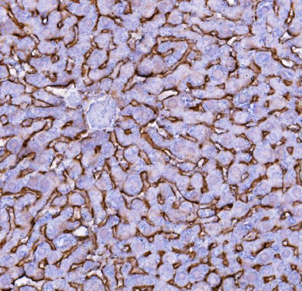 pb9745 slc10a1 primary antibodies ihc testing 2