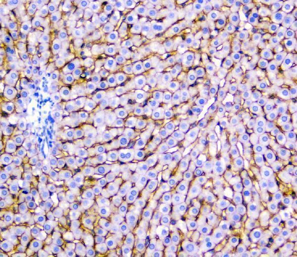 pb9745 slc10a1 primary antibodies ihc testing 3