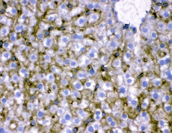 pb9745 slc10a1 primary antibodies ihc testing 4
