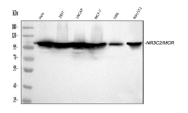 Western blot analysis of NR3C2 using anti-NR3C2 antibody (PB9765).