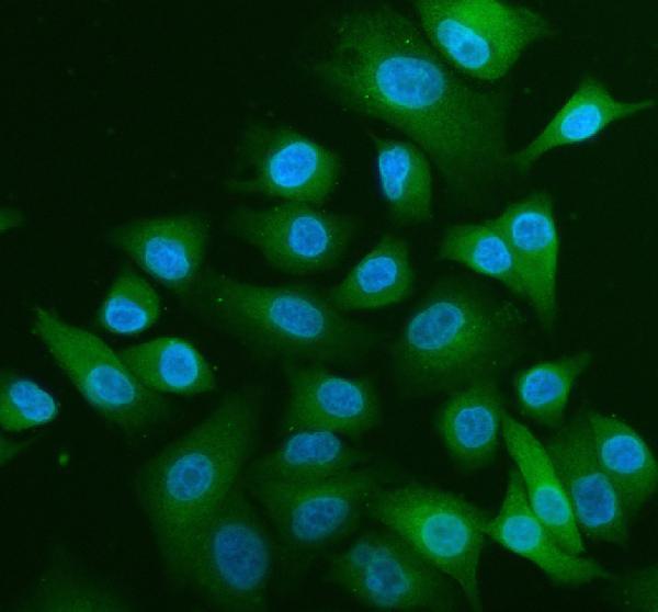  IF analysis of ALIX using anti-ALIX antibody (PB9770)