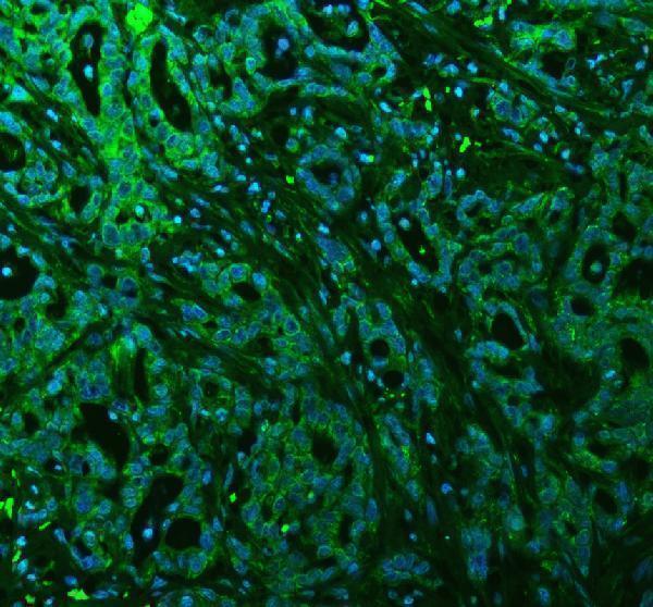 pb9770 alix primary antibodies if testing 4