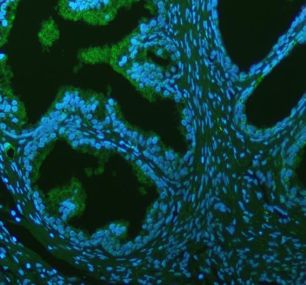 pb9770 alix primary antibodies if testing 5