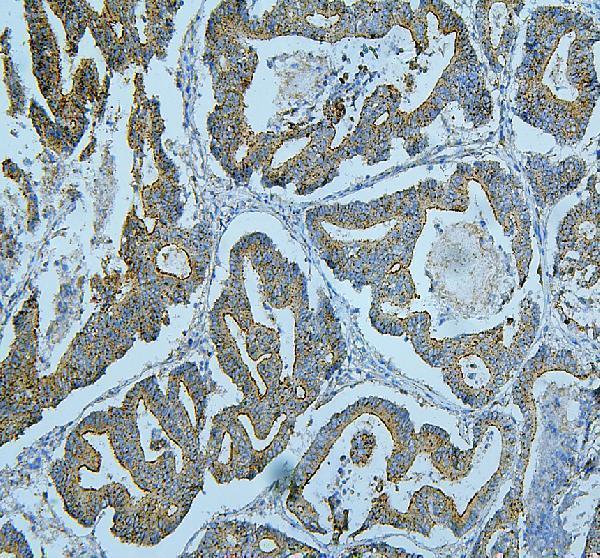  IHC analysis of ALIX using anti-ALIX antibody (PB9770)