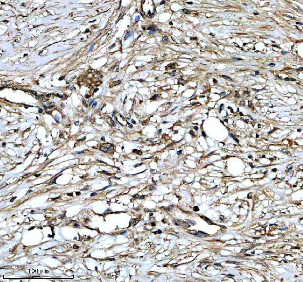 pb9771 ihc 4