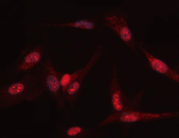 Figure 2. IF analysis of PGK1 using anti-PGK1 antibody (PB9774). PGK1 was detected in an immunocytochemical section of U87 cells. Enzyme antigen retrieval was performed using IHC enzyme antigen retrieval reagent (AR0022) for 15 mins. The cells were blocked with 10% goat serum. And then incubated with 5 microg/mL rabbit anti-PGK1 Antibody (PB9774) overnight at 4°C. Cy3 Conjugated Goat Anti-Rabbit IgG (BA1032) was used as secondary antibody at 1:500 dilution and incubated for 30 minutes at 37°C. Visualize using a fluorescence microscope and filter sets appropriate for the label used. Figure 2. IF analysis of PGK1 using anti-PGK1 antibody (PB9774). PGK1 was detected in an immunocytochemical section of U87 cells. Enzyme antigen retrieval was performed using IHC enzyme antigen retrieval reagent (AR0022) for 15 mins. The cells were blocked with 10% goat serum. And then incubated with 5 microg/mL rabbit anti-PGK1 Antibody (PB9774) overnight at 4°C. Cy3 Conjugated Goat Anti-Rabbit IgG (BA1032) was used as secondary antibody at 1:500 dilution and incubated for 30 minutes at 37°C. Visualize using a fluorescence microscope and filter sets appropriate for the label used.