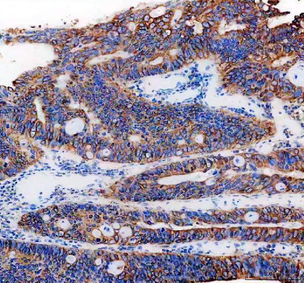 pb9775 pgrmc1 primary antibodies ihc testing 1