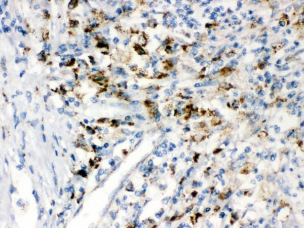 pb9781 2 ihc anti ppt1 cln1 picoband antibody
