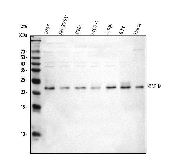 Western blot analysis of Rab11A using anti-Rab11A antibody (PB9789)