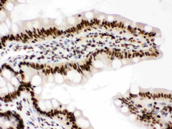 pb9797 10_1 ihc anti rbap48 picoband antibody
