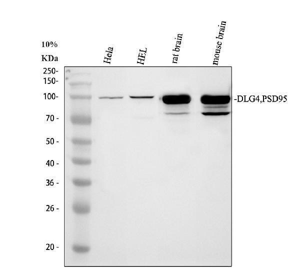 Western blot analysis of PSD95/DLG4 using anti-PSD95/DLG4 antibody (PB9802)