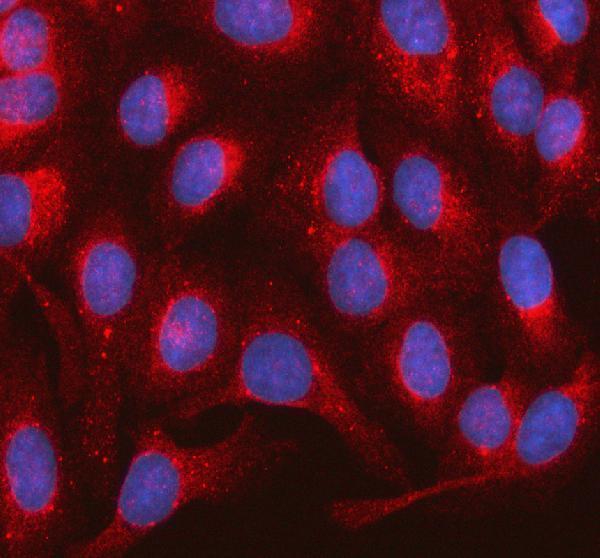 pb9815 rab14 primary antibodies if testing 1
