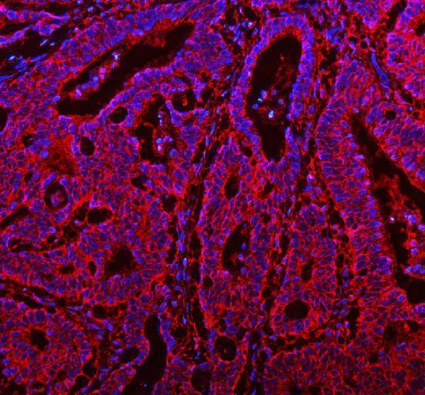 pb9815 rab14 primary antibodies if testing 2