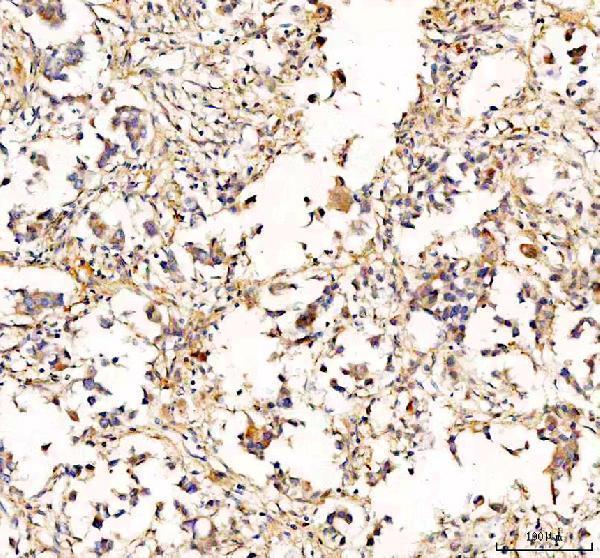 pb9815 rab14 primary antibodies ihc testing 1