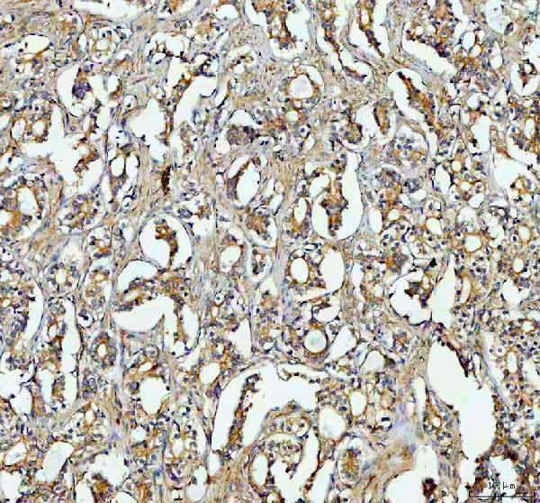 pb9815 rab14 primary antibodies ihc testing 2