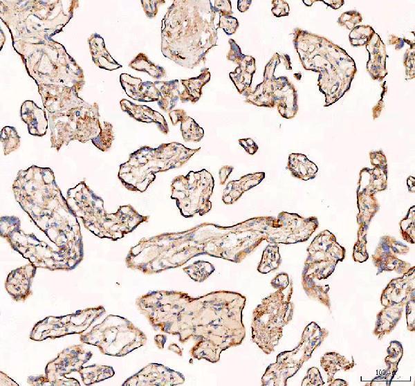 pb9815 rab14 primary antibodies ihc testing 3