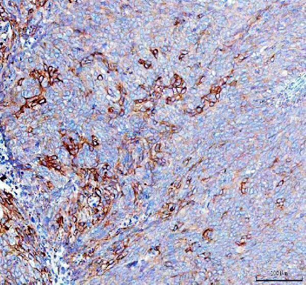 pb9815 rab14 primary antibodies ihc testing 4