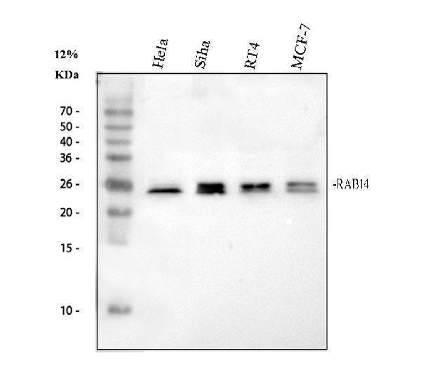 pb9815 rab14 primary antibodies wb testing 1