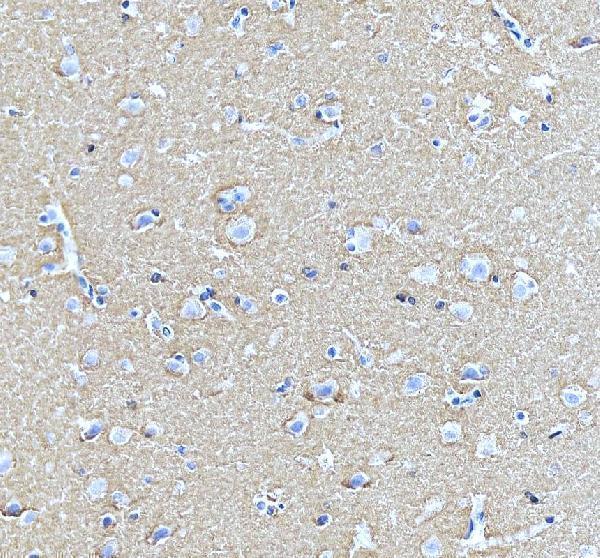 pb9819 stxbp1 primary antibodies ihc testing 5