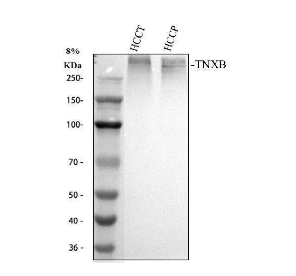 pb9833 tnxb primary antibodies wb testing 1