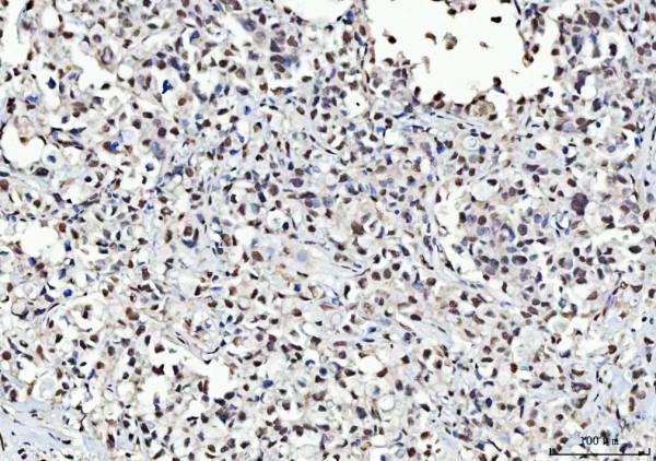 pb9835 kap1 primary antibodies ihc testing 6_1