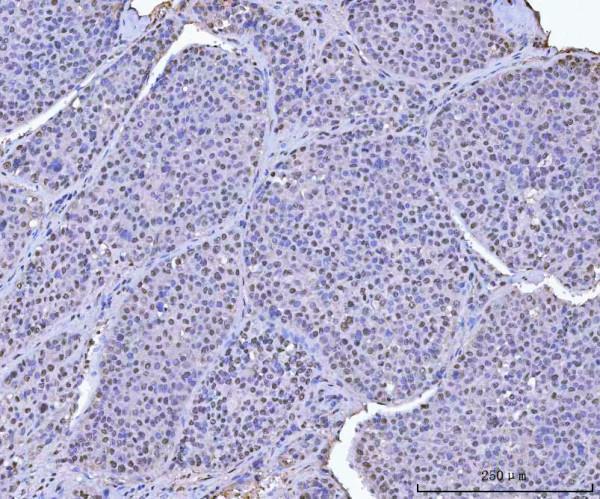 pb9835 kap1 primary antibodies ihc testing 7_1