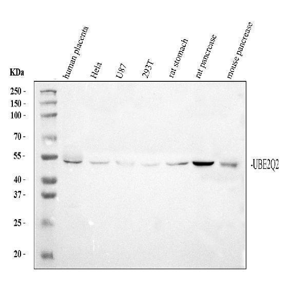 Western blot analysis of UBE2Q2 using anti-UBE2Q2 antibody (PB9839)