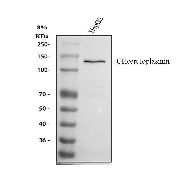 Western blot analysis of Ceruloplasmin using anti-Ceruloplasmin antibody (PB9852)