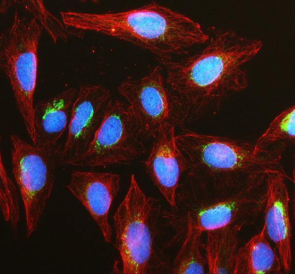 pb9860 diablo primary antibodies if testing 1