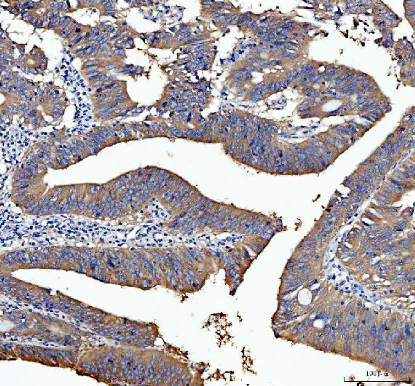 pb9860 diablo primary antibodies ihc testing 1