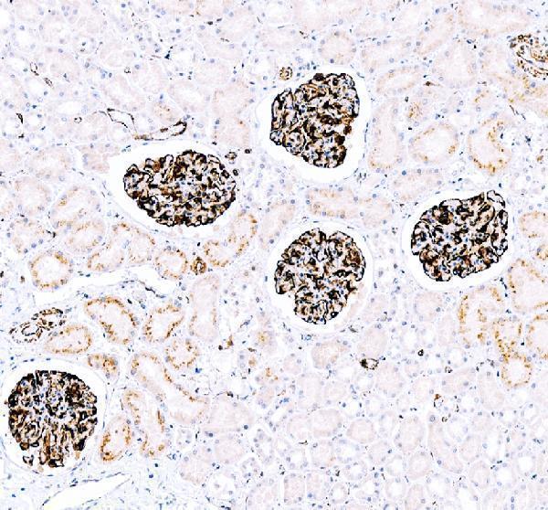 pb9874 nestin primary antibodies ihc testing 1