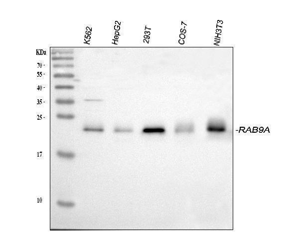 Western blot analysis of Rab9/RAB9A using anti-Rab9/RAB9A antibody (PB9884)