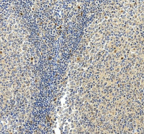 pb9890 skap1 primary antibodies ihc testing 3_1