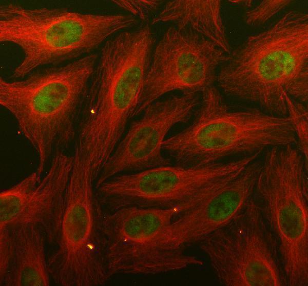 IF analysis of TRIB2 using antiTRIB2 antibody (PB9900)