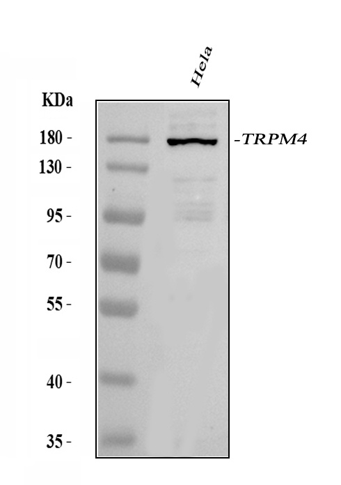 Figure 1. Western blot analysis of TRPM4 using anti-TRPM4 antibody (PB9902). Electrophoresis was performed on a 5-20% SDS-PAGE gel at 70V (Stacking gel) / 90V (Resolving gel) for 2-3 hours. The sample well of each lane was loaded with 30 ug of sample under reducing conditions. Lane 1: human Hela whole cell lysates. After electrophoresis, proteins were transferred to a nitrocellulose membrane at 150 mA for 50-90 minutes. Blocked the membrane with 5% non-fat milk/TBS for 1.5 hour at RT. The membrane was incubated with rabbit anti-TRPM4 antigen affinity purified polyclonal antibody (Catalog # PB9902) at 0.5 microg/mL overnight at 4°C, then washed with TBS-0.1%Tween 3 times with 5 minutes each and probed with a goat anti-rabbit IgG-HRP secondary antibody at a dilution of 1:5000 for 1.5 hour at RT. The signal is developed using an Enhanced Chemiluminescent detection (ECL) kit (Catalog # EK1002) with Tanon 5200 system. A specific band was detected for TRPM4 at approximately 167 kDa. The expected band size for TRPM4 is at 134 kDa.