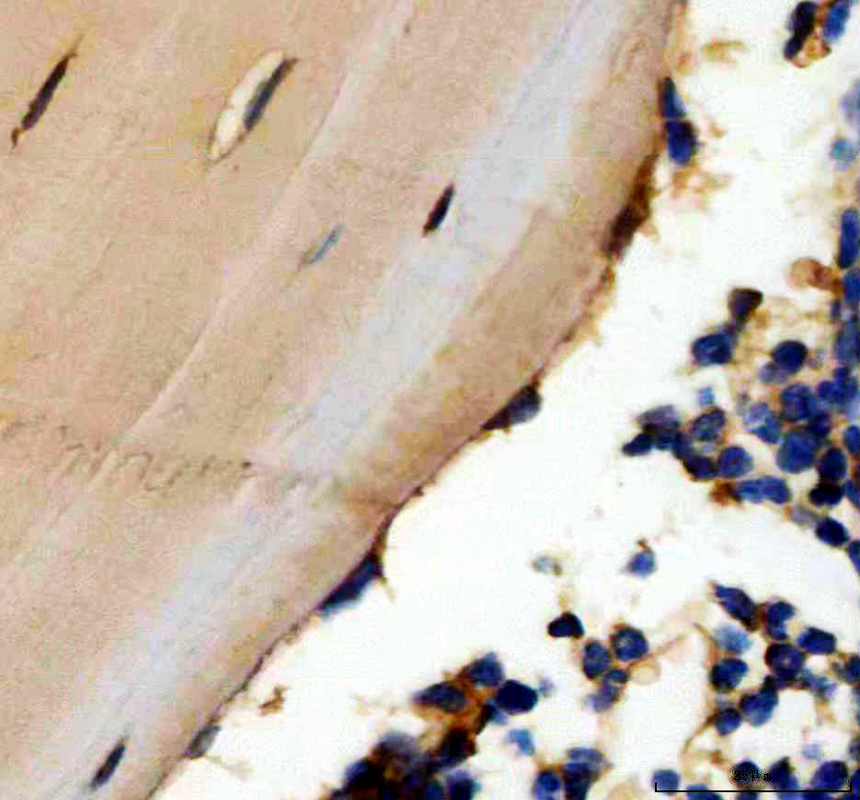 IHC analysis of Osteocalcin/BGLAP using anti-Osteocalcin/BGLAP antibody (PB9919)