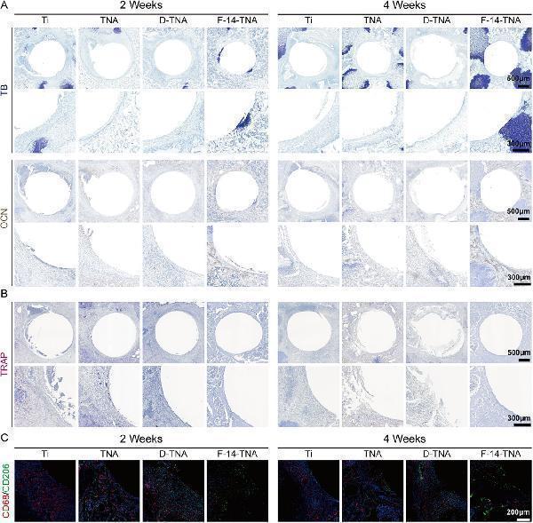 pb9920 advs71685 fig 0011 m